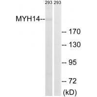 Western blot analysis of extracts from 293 cells, using MYH14 antibody #34819.