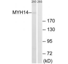 Western blot - MYH14 Antibody from Signalway Antibody (34819) - Antibodies.com
