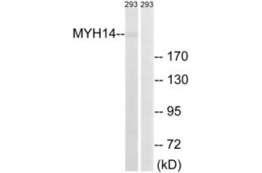 Western blot - MYH14 Antibody from Signalway Antibody (34819) - Antibodies.com