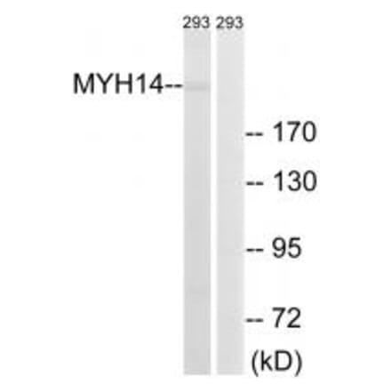 Western blot - MYH14 Antibody from Signalway Antibody (34819) - Antibodies.com