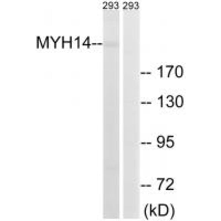 Western blot - MYH14 Antibody from Signalway Antibody (34819) - Antibodies.com