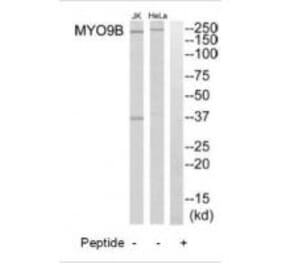 Western blot - MYO9B Antibody from Signalway Antibody (34823) - Antibodies.com
