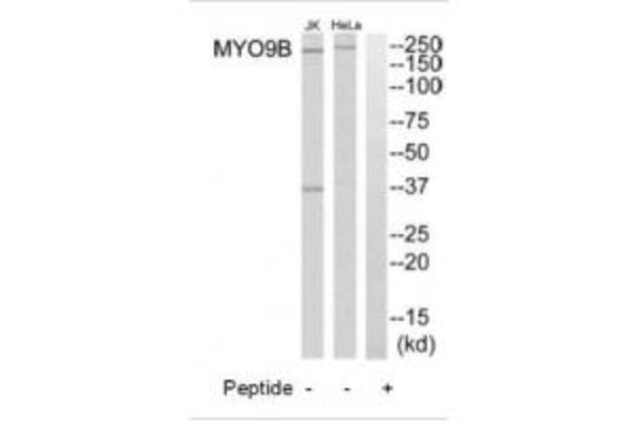Western blot - MYO9B Antibody from Signalway Antibody (34823) - Antibodies.com