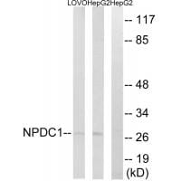 Western blot analysis of extracts from LOVO cells and HepG2 cells, using NPDC1 antibody #34848.