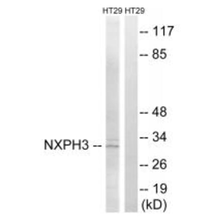 Western blot - NXPH3 Antibody from Signalway Antibody (34851) - Antibodies.com