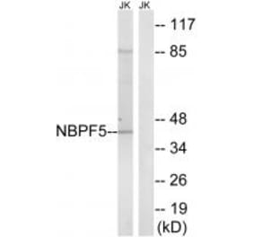 Western blot - NBPF5 Antibody from Signalway Antibody (34854) - Antibodies.com