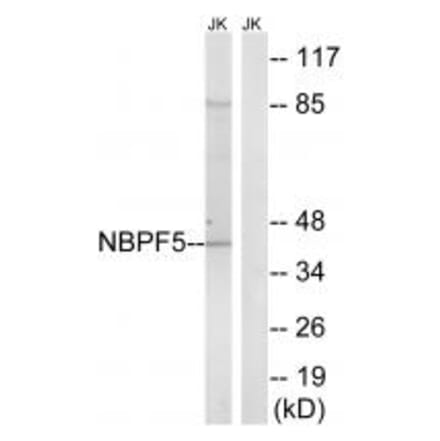Western blot - NBPF5 Antibody from Signalway Antibody (34854) - Antibodies.com