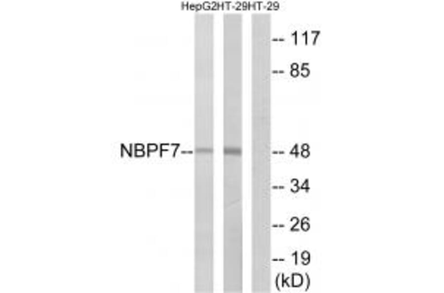 Western blot - NBPF7 Antibody from Signalway Antibody (34855) - Antibodies.com
