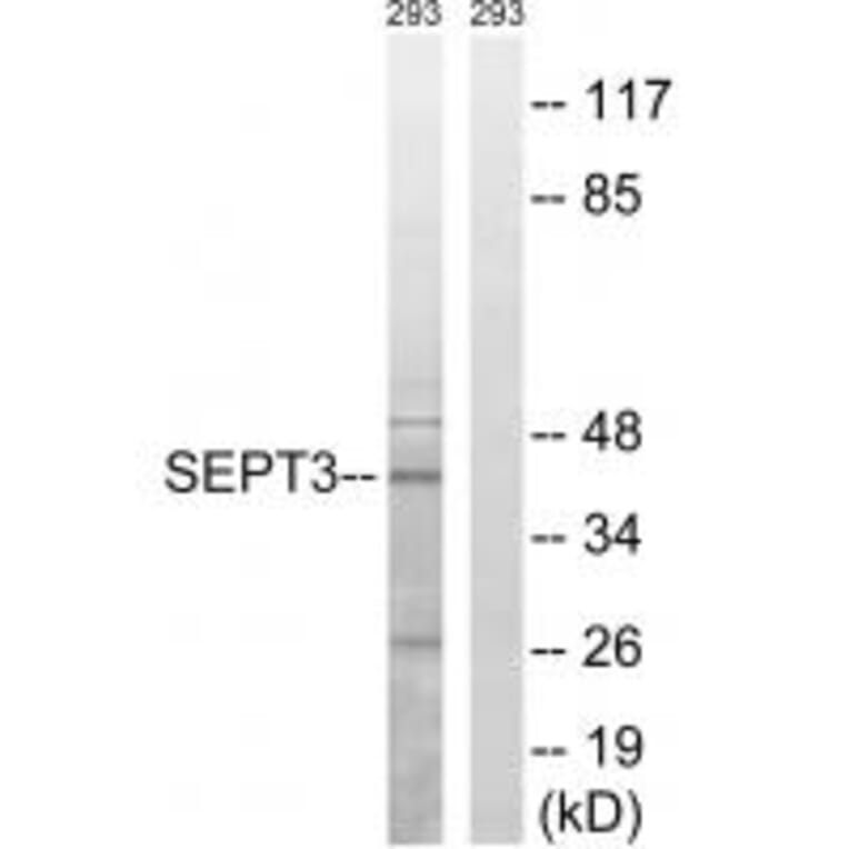 Western blot - SEPT3 Antibody from Signalway Antibody (34860) - Antibodies.com