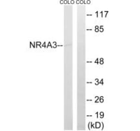 Western blot - NR4A3 Antibody from Signalway Antibody (34884) - Antibodies.com
