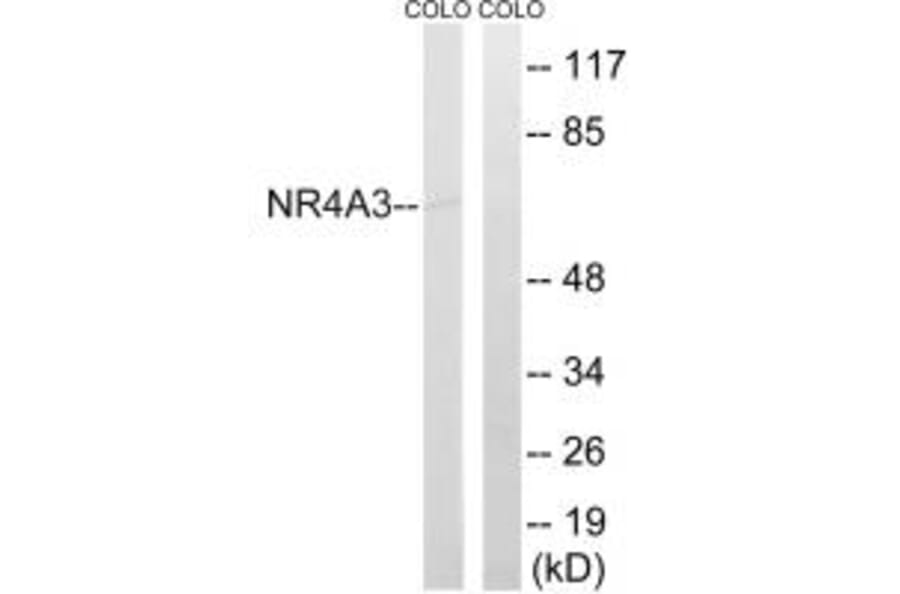 Western blot - NR4A3 Antibody from Signalway Antibody (34884) - Antibodies.com