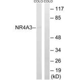 Western blot - NR4A3 Antibody from Signalway Antibody (34884) - Antibodies.com