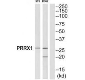 Western blot - PRRX1 Antibody from Signalway Antibody (34886) - Antibodies.com
