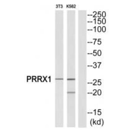 Western blot - PRRX1 Antibody from Signalway Antibody (34886) - Antibodies.com