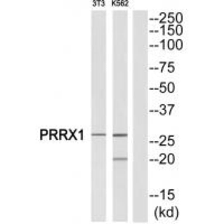 Western blot - PRRX1 Antibody from Signalway Antibody (34886) - Antibodies.com