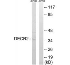 Western blot - DECR2 Antibody from Signalway Antibody (34889) - Antibodies.com
