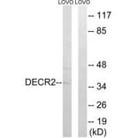 Western blot - DECR2 Antibody from Signalway Antibody (34889) - Antibodies.com