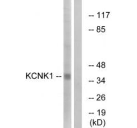 Western blot - KCNK1 Antibody from Signalway Antibody (34910) - Antibodies.com