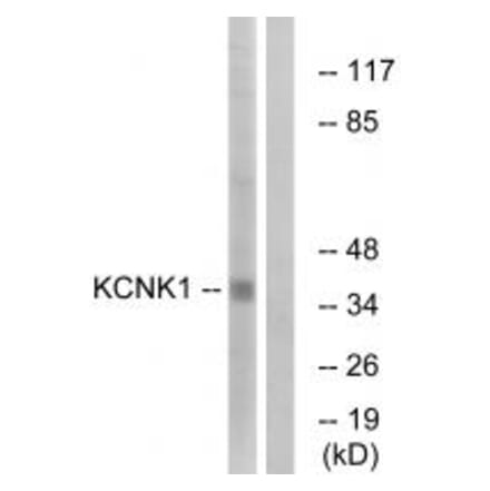 Western blot - KCNK1 Antibody from Signalway Antibody (34910) - Antibodies.com