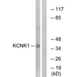 Western blot - KCNK1 Antibody from Signalway Antibody (34910) - Antibodies.com