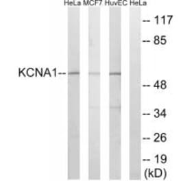 Western blot - KCNA1 Antibody from Signalway Antibody (34914) - Antibodies.com