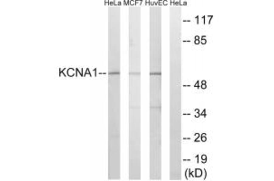 Western blot - KCNA1 Antibody from Signalway Antibody (34914) - Antibodies.com