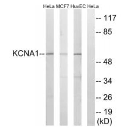 Western blot - KCNA1 Antibody from Signalway Antibody (34914) - Antibodies.com