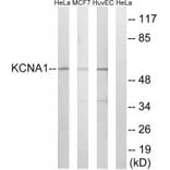 Western blot - KCNA1 Antibody from Signalway Antibody (34914) - Antibodies.com