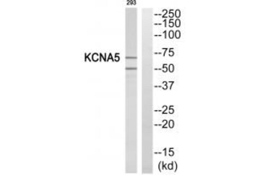 Western blot - KCNA5 Antibody from Signalway Antibody (34915) - Antibodies.com