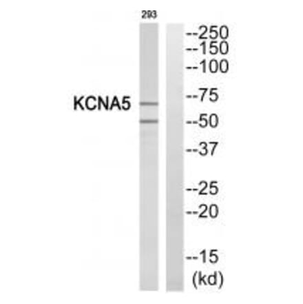 Western blot - KCNA5 Antibody from Signalway Antibody (34915) - Antibodies.com