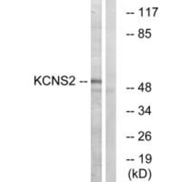 Western blot - KCNS2 Antibody from Signalway Antibody (34921) - Antibodies.com