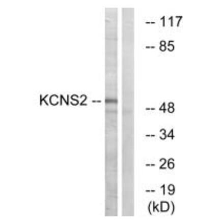 Western blot - KCNS2 Antibody from Signalway Antibody (34921) - Antibodies.com