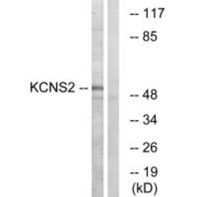 Western blot - KCNS2 Antibody from Signalway Antibody (34921) - Antibodies.com