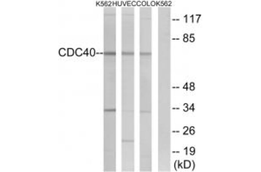 Western blot - CDC40 Antibody from Signalway Antibody (34923) - Antibodies.com