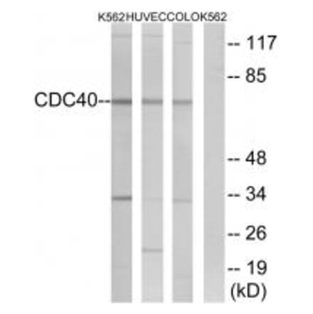 Western blot - CDC40 Antibody from Signalway Antibody (34923) - Antibodies.com
