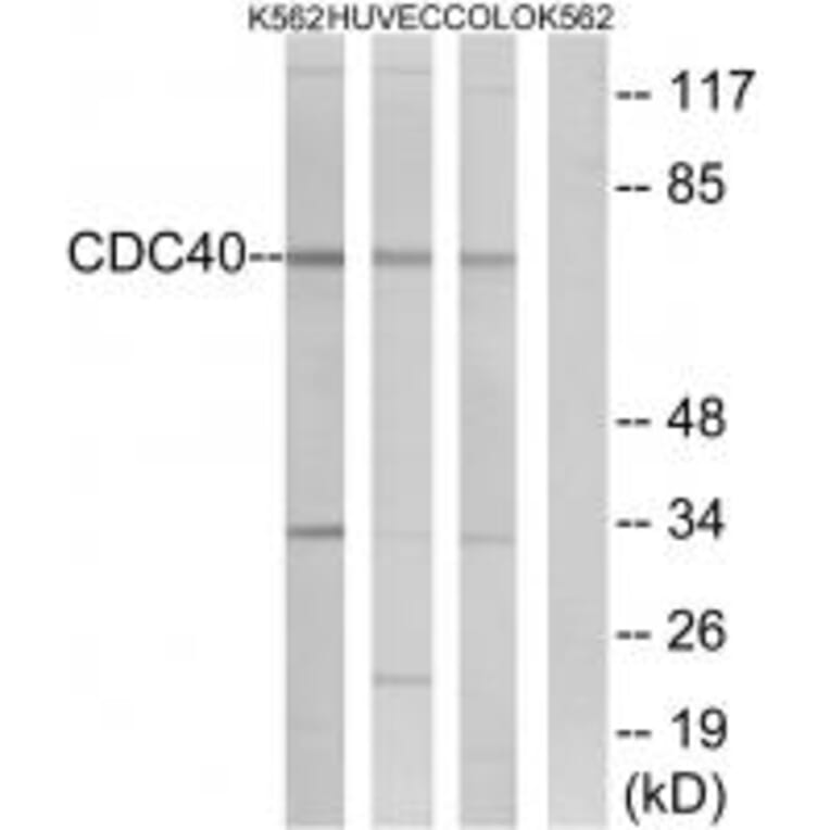 Western blot - CDC40 Antibody from Signalway Antibody (34923) - Antibodies.com