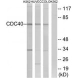 Western blot - CDC40 Antibody from Signalway Antibody (34923) - Antibodies.com