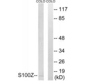 Western blot - S100Z Antibody from Signalway Antibody (34938) - Antibodies.com