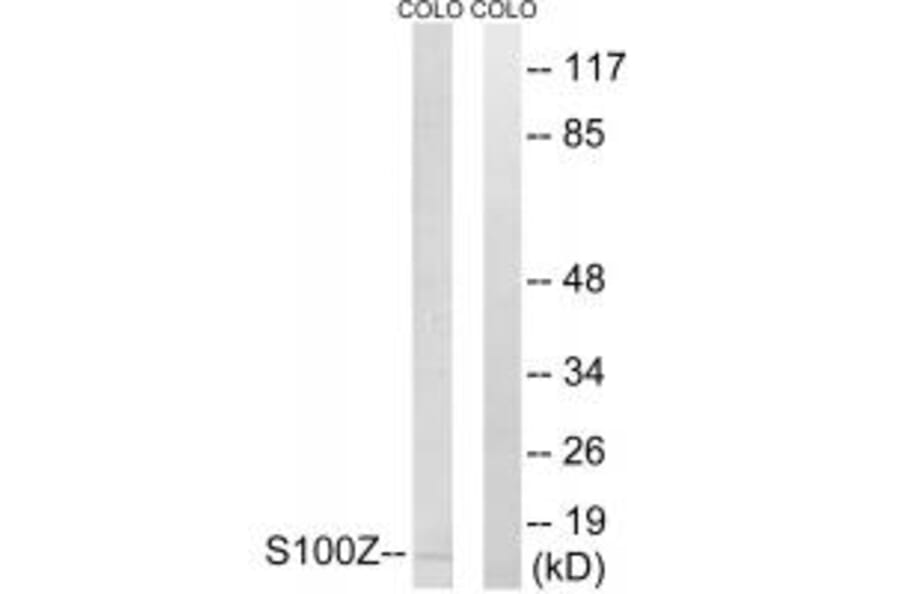 Western blot - S100Z Antibody from Signalway Antibody (34938) - Antibodies.com