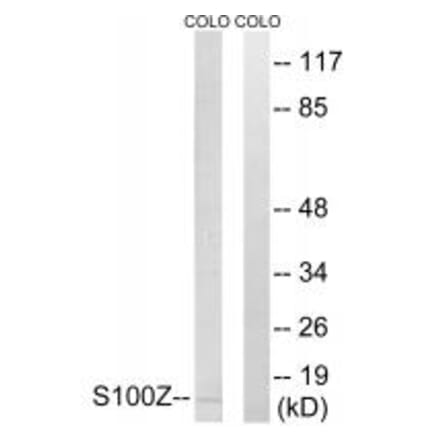 Western blot - S100Z Antibody from Signalway Antibody (34938) - Antibodies.com