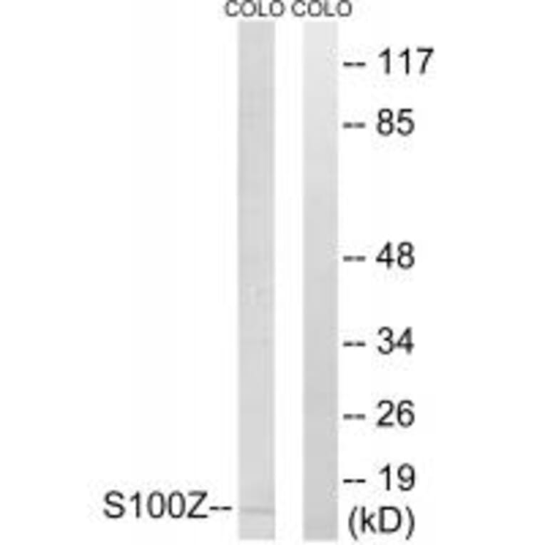 Western blot - S100Z Antibody from Signalway Antibody (34938) - Antibodies.com