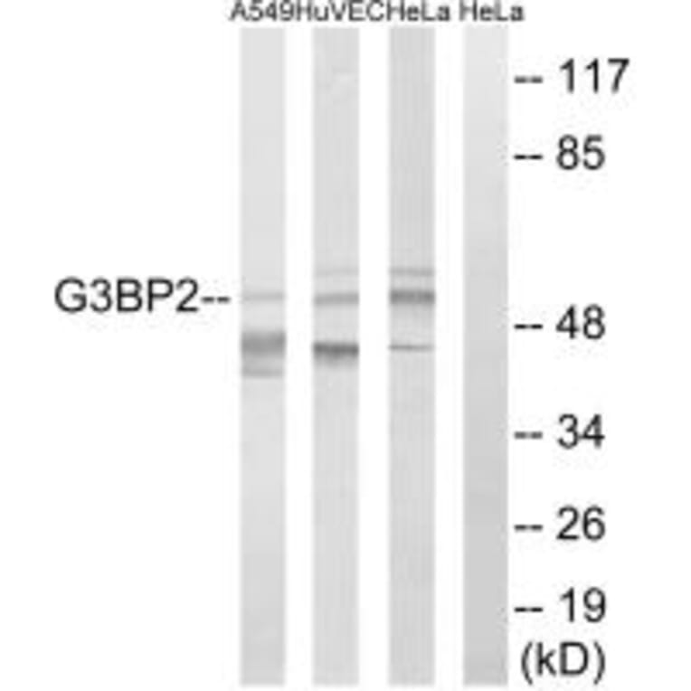 Western blot - G3BP2 Antibody from Signalway Antibody (34963) - Antibodies.com