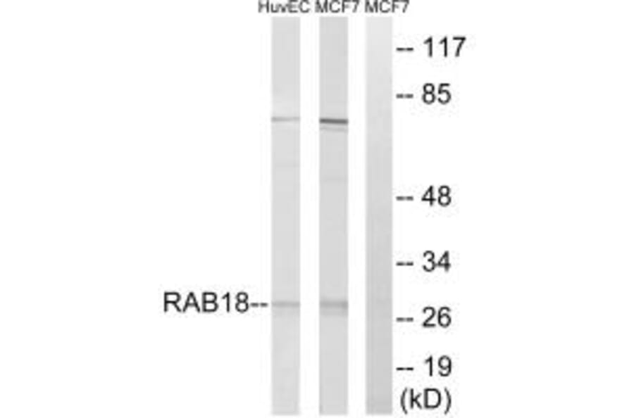 Western blot - RAB18 Antibody from Signalway Antibody (34966) - Antibodies.com