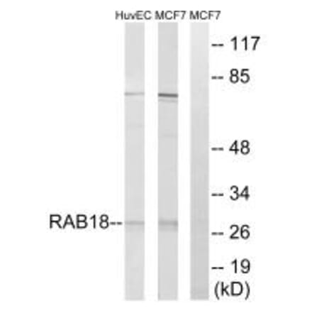 Western blot - RAB18 Antibody from Signalway Antibody (34966) - Antibodies.com