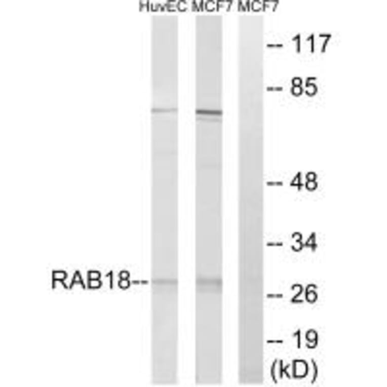 Western blot - RAB18 Antibody from Signalway Antibody (34966) - Antibodies.com