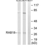 Western blot - RAB18 Antibody from Signalway Antibody (34966) - Antibodies.com