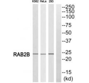 Western blot - RAB2B Antibody from Signalway Antibody (34967) - Antibodies.com