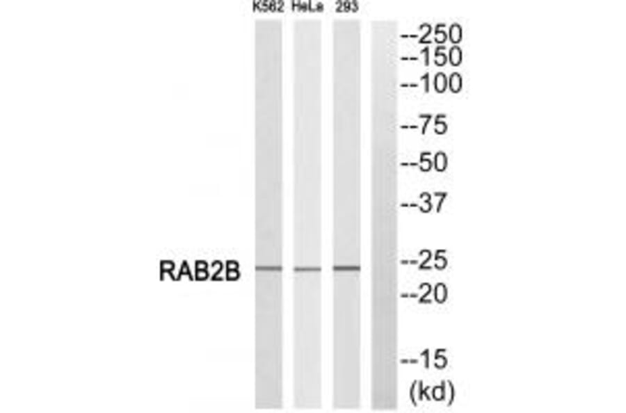 Western blot - RAB2B Antibody from Signalway Antibody (34967) - Antibodies.com