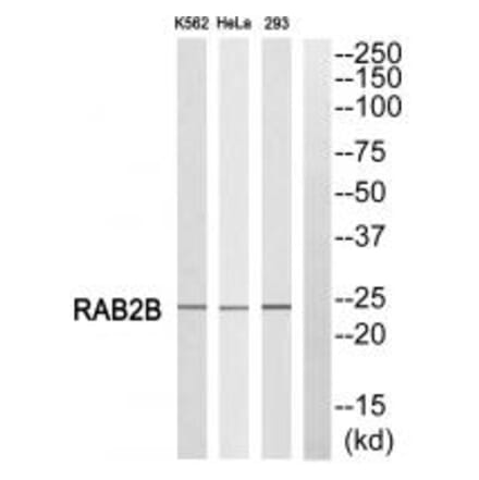 Western blot - RAB2B Antibody from Signalway Antibody (34967) - Antibodies.com