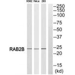 Western blot - RAB2B Antibody from Signalway Antibody (34967) - Antibodies.com